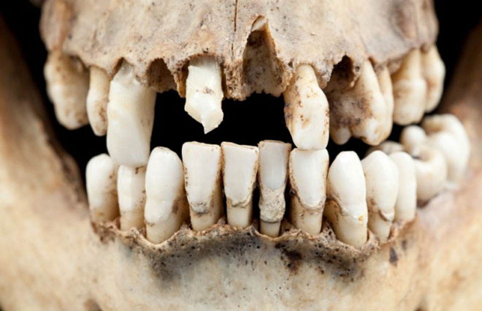 Our-Ancestors-Had-Better-Teeth-Than-Us.-Where-Did-We-Go-Wrong